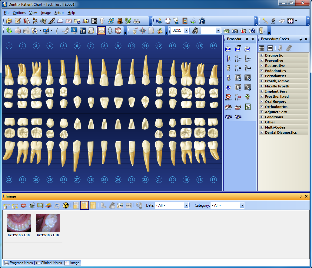 dental intraoral camera software download free