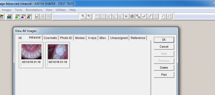 Intraoral Camera Software for Dentrix Image