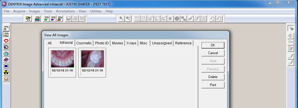 Intraoral Camera Software for Dentrix Image