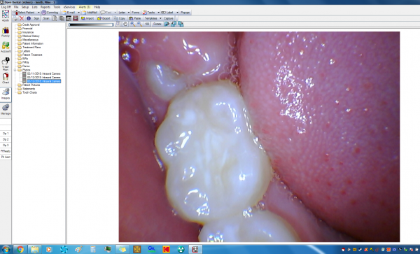 open dental tutorial open dental tutorial