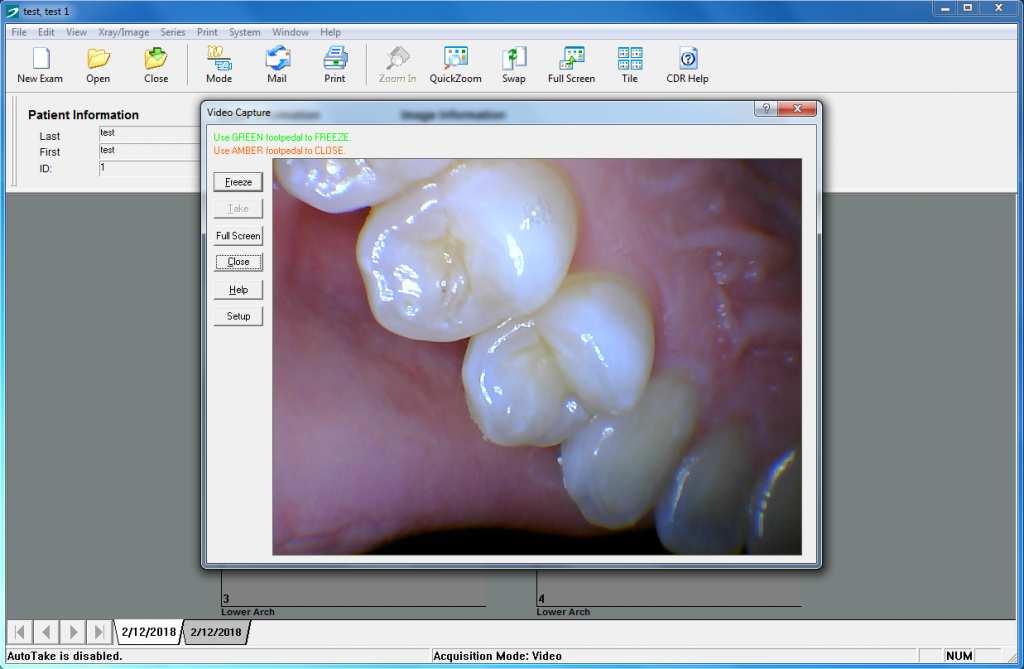 Schick CDR 3.5 | IOC Snapshot